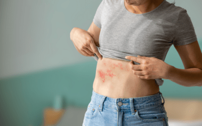 Shingles Vaccine adult immunisation update and report